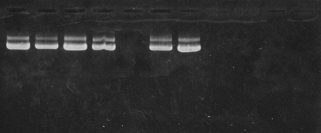 전기영동 결과(plasmid DNA) 썸네일 이미지